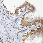 MNK1 Antibody in Immunohistochemistry (Paraffin) (IHC (P))