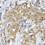 MNK1 Antibody in Immunohistochemistry (Paraffin) (IHC (P))