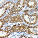 MNK1 Antibody in Immunohistochemistry (Paraffin) (IHC (P))