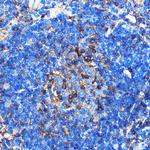 SERC1 Antibody in Immunohistochemistry (Paraffin) (IHC (P))