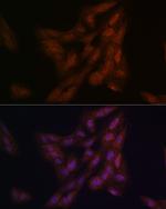 DJ-1 Antibody in Immunocytochemistry (ICC/IF)