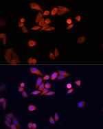 DJ-1 Antibody in Immunocytochemistry (ICC/IF)