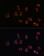 DJ-1 Antibody in Immunocytochemistry (ICC/IF)