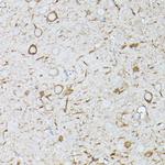 IFNAR1 Antibody in Immunohistochemistry (Paraffin) (IHC (P))