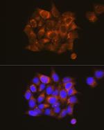 PKM1 Antibody in Immunocytochemistry (ICC/IF)