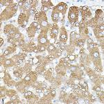 PKM1 Antibody in Immunohistochemistry (Paraffin) (IHC (P))