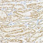 PKM1 Antibody in Immunohistochemistry (Paraffin) (IHC (P))