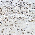 TRRAP Antibody in Immunohistochemistry (Paraffin) (IHC (P))