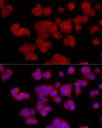 EPHX2 Antibody in Immunocytochemistry (ICC/IF)
