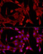 EPHX2 Antibody in Immunocytochemistry (ICC/IF)