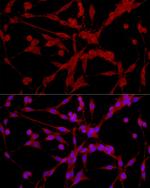 EPHX2 Antibody in Immunocytochemistry (ICC/IF)