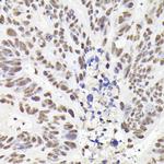 RAD21 Antibody in Immunohistochemistry (Paraffin) (IHC (P))