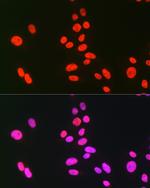 hnRNP C Antibody in Immunocytochemistry (ICC/IF)