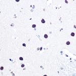 hnRNP C Antibody in Immunohistochemistry (Paraffin) (IHC (P))