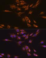 CNTF Antibody in Immunocytochemistry (ICC/IF)