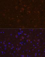 CNTF Antibody in Immunohistochemistry (Paraffin) (IHC (P))