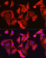 GPX4 Antibody in Immunocytochemistry (ICC/IF)