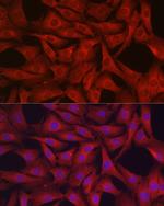 GPX4 Antibody in Immunocytochemistry (ICC/IF)