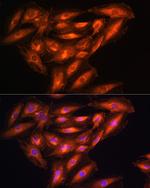 PHGDH Antibody in Immunocytochemistry (ICC/IF)