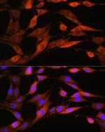 ASS1 Antibody in Immunocytochemistry (ICC/IF)