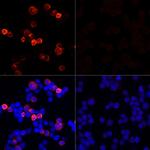 SARS-CoV-2 Spike Protein S1 Antibody in Immunocytochemistry (ICC/IF)