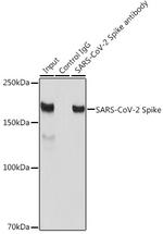 SARS-CoV-2 Spike Protein S1 Antibody in Immunoprecipitation (IP)