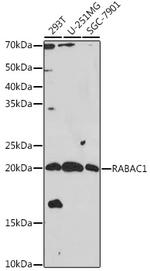 RABAC1 Antibody in Western Blot (WB)