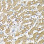 RSK1/RSK2/RSK3 Antibody in Immunohistochemistry (Paraffin) (IHC (P))