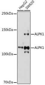 ALPK1 Antibody in Western Blot (WB)