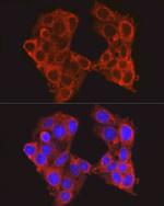 PCK1 Antibody in Immunocytochemistry (ICC/IF)