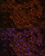 PCK1 Antibody in Immunohistochemistry (Paraffin) (IHC (P))