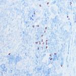 S100A8 Antibody in Immunohistochemistry (Paraffin) (IHC (P))