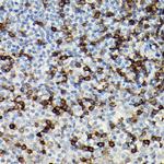 CD3 zeta (CD247) Antibody in Immunohistochemistry (Paraffin) (IHC (P))