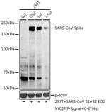 SARS Coronavirus Spike Protein Antibody in Western Blot (WB)