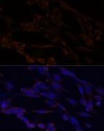 IKK alpha Antibody in Immunocytochemistry (ICC/IF)