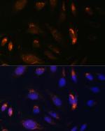 IKK alpha Antibody in Immunocytochemistry (ICC/IF)