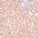 IKK alpha Antibody in Immunohistochemistry (Paraffin) (IHC (P))