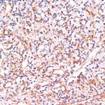 IKK alpha Antibody in Immunohistochemistry (Paraffin) (IHC (P))