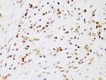 IKK beta Antibody in Immunohistochemistry (Paraffin) (IHC (P))