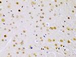 IKK beta Antibody in Immunohistochemistry (Paraffin) (IHC (P))