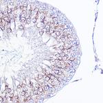 Integrin alpha V (CD51) Antibody in Immunohistochemistry (Paraffin) (IHC (P))