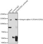 Integrin alpha V (CD51) Antibody in Immunoprecipitation (IP)