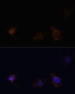 Zyxin Antibody in Immunocytochemistry (ICC/IF)