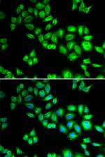 Cullin 1 Antibody in Immunocytochemistry (ICC/IF)