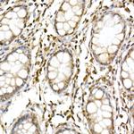 Cullin 1 Antibody in Immunohistochemistry (Paraffin) (IHC (P))