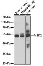 MBD2 Antibody in Western Blot (WB)