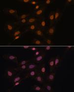 HP1 gamma Antibody in Immunocytochemistry (ICC/IF)