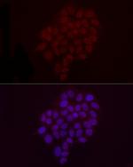 H3K9me2 Antibody in Immunocytochemistry (ICC/IF)