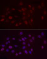 H3K9me2 Antibody in Immunocytochemistry (ICC/IF)