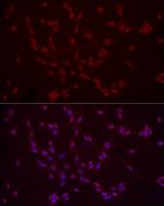 H3K9me2 Antibody in Immunocytochemistry (ICC/IF)